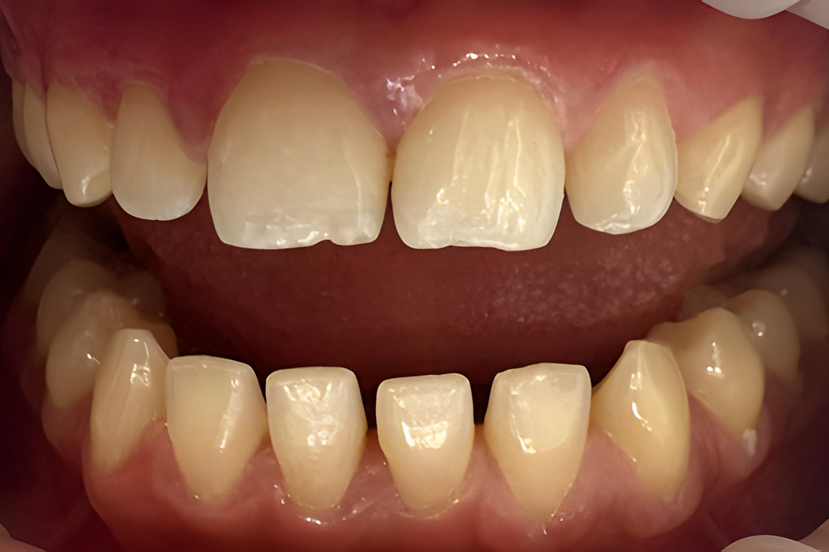 Case 02, Before
