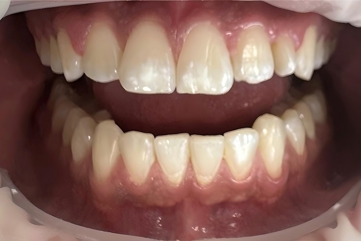 Case 03, Before