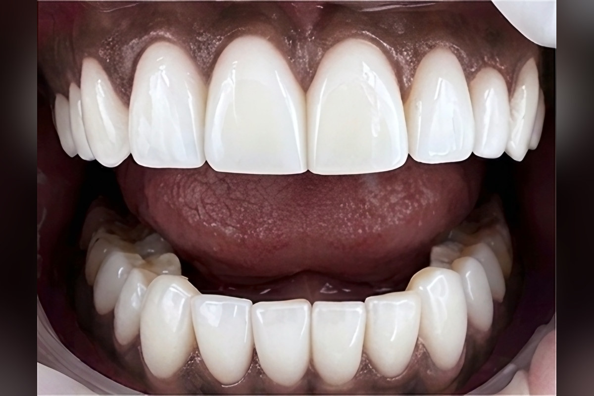 Case 04, After