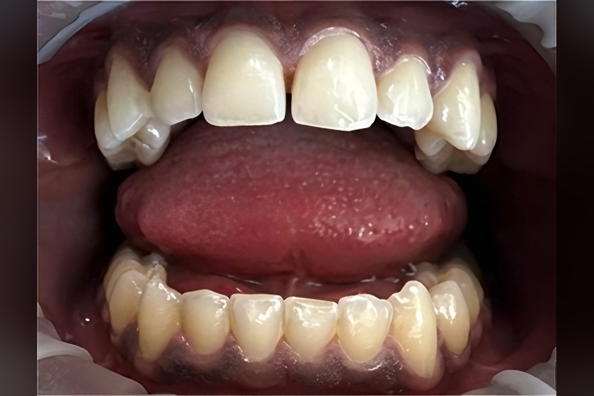 Case 04, Before
