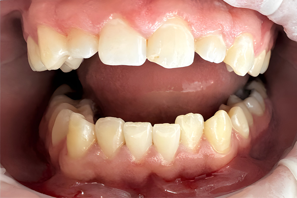 Case 05, Before